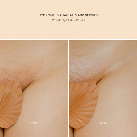 Bushbalm- Hydrogel Vajacial Triangle Mask