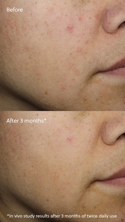 Vitamin C+ Serum