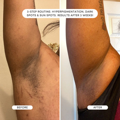 Bushbalm- Dark Spot Oil ~ PINA COLADA