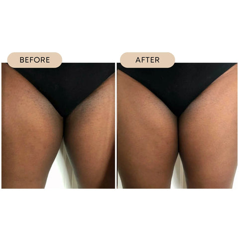 Bushbalm- Dark Spot Oil ~ PINA COLADA