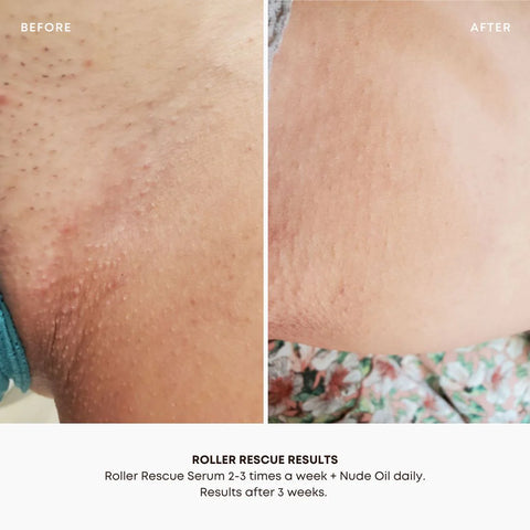 Bushbalm- Roller Rescue Soothing Serum