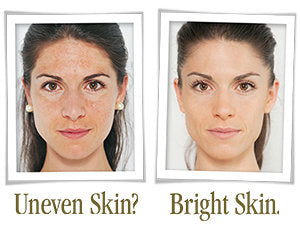 Bright Skin Starter Set