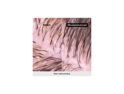 Scalp Advanced | Anti-Discomfort Intense Soother Treatment