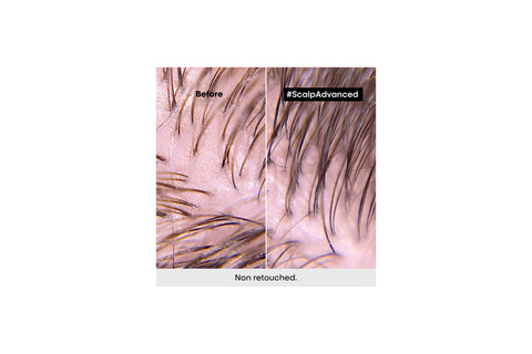 Scalp Advanced | Anti-Oiliness Dermo Purifier Shampoo